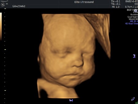 Wellbeing & 3D Scan 2